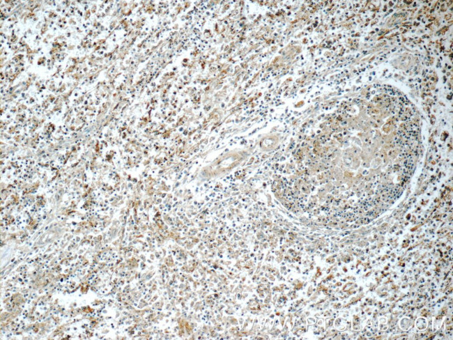 RNASEL Antibody in Immunohistochemistry (Paraffin) (IHC (P))