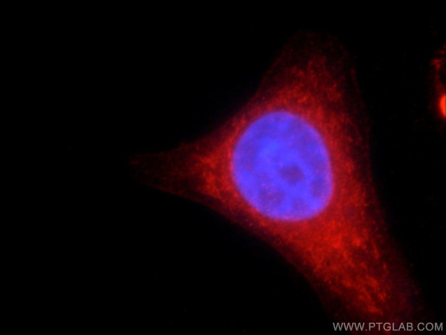 RNASEL Antibody in Immunocytochemistry (ICC/IF)