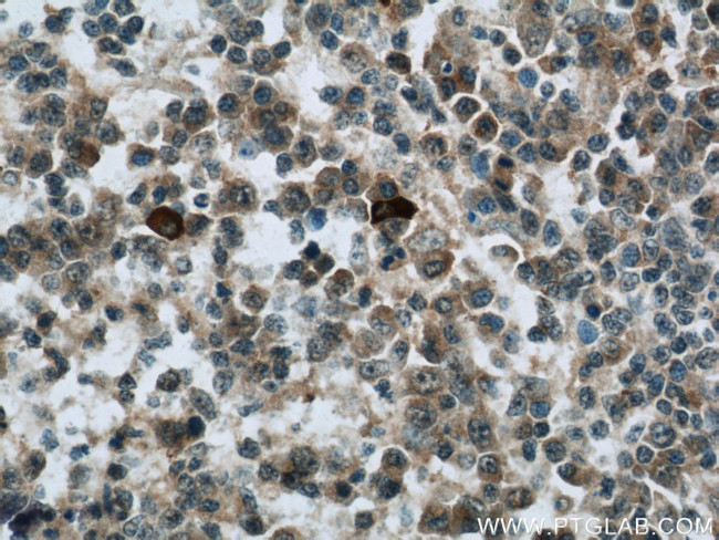 RNASEL Antibody in Immunohistochemistry (Paraffin) (IHC (P))