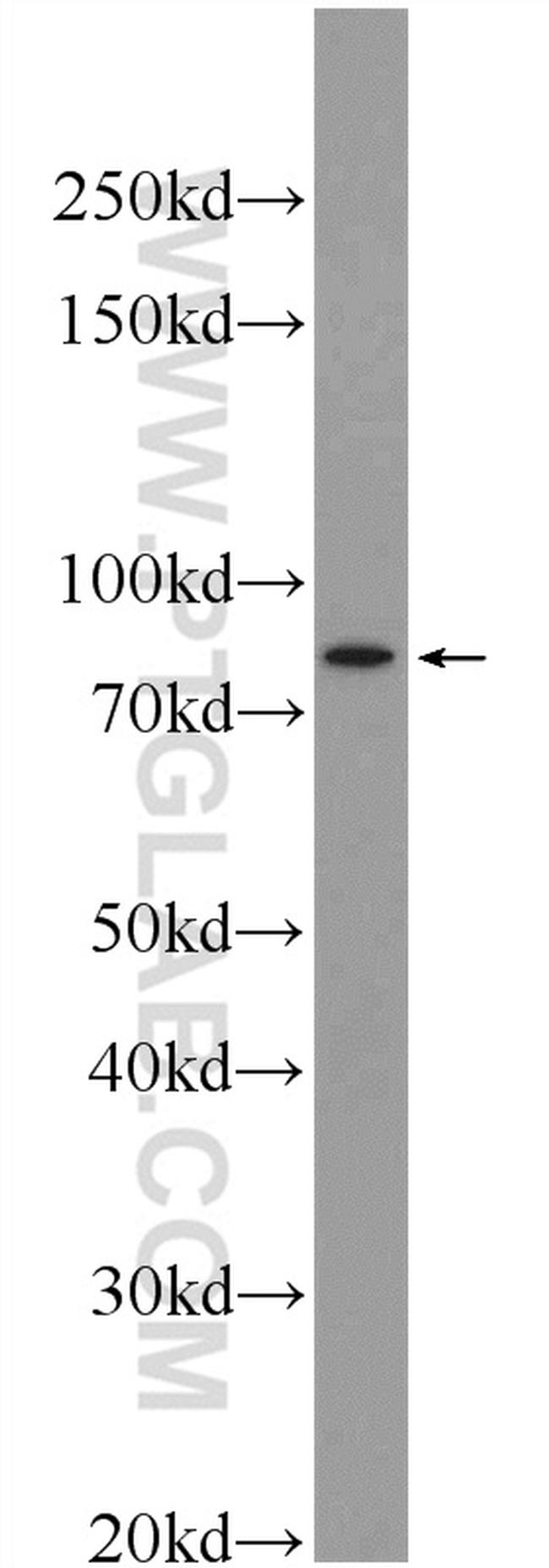 RNASEL Antibody in Western Blot (WB)