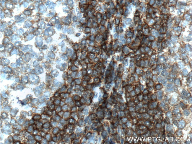 TNFRSF13C Antibody in Immunohistochemistry (Paraffin) (IHC (P))