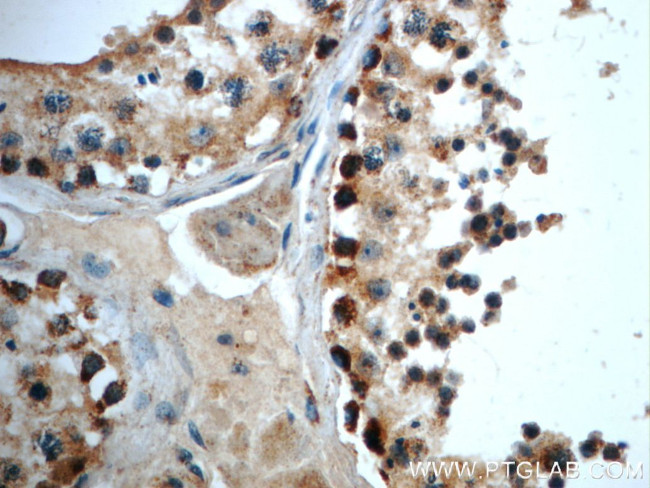 TFAM Antibody in Immunohistochemistry (Paraffin) (IHC (P))