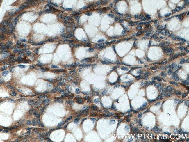 TFAM Antibody in Immunohistochemistry (Paraffin) (IHC (P))