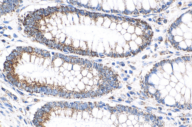 TFAM Antibody in Immunohistochemistry (Paraffin) (IHC (P))