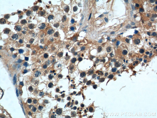 WBP2NL Antibody in Immunohistochemistry (Paraffin) (IHC (P))