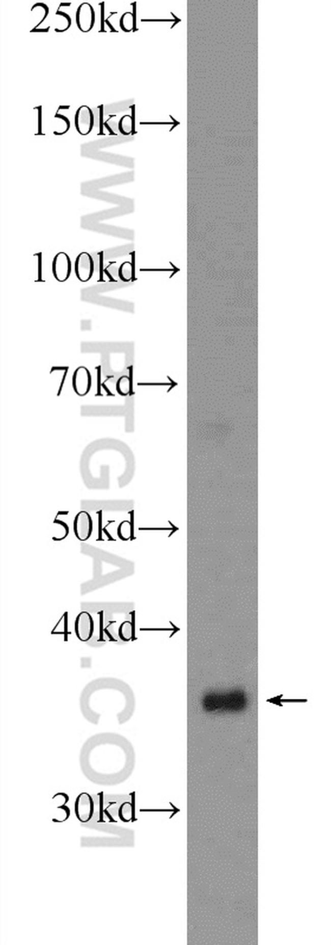 WBP2NL Antibody in Western Blot (WB)