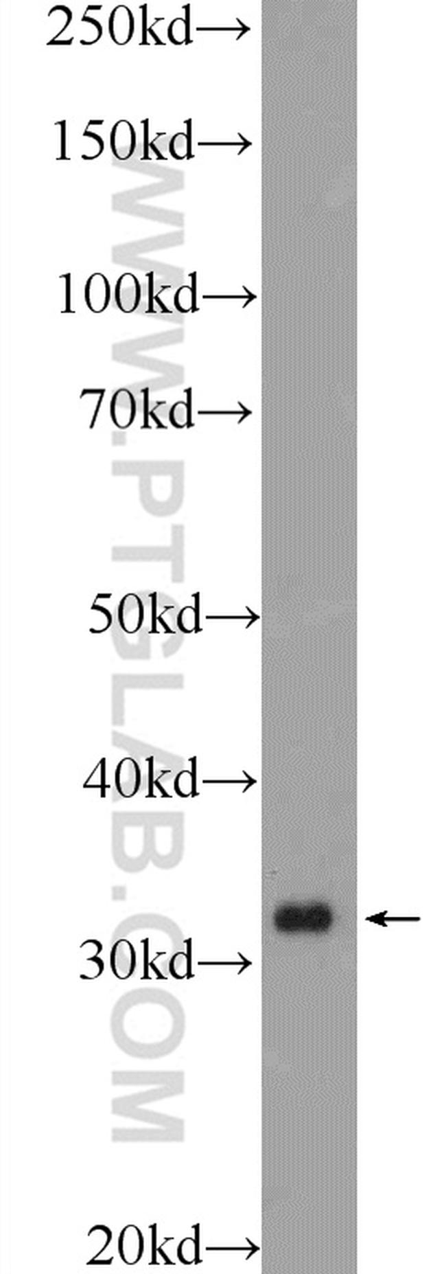 WBP2NL Antibody in Western Blot (WB)