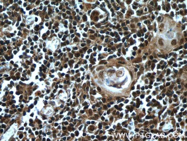 KDM4D Antibody in Immunohistochemistry (Paraffin) (IHC (P))