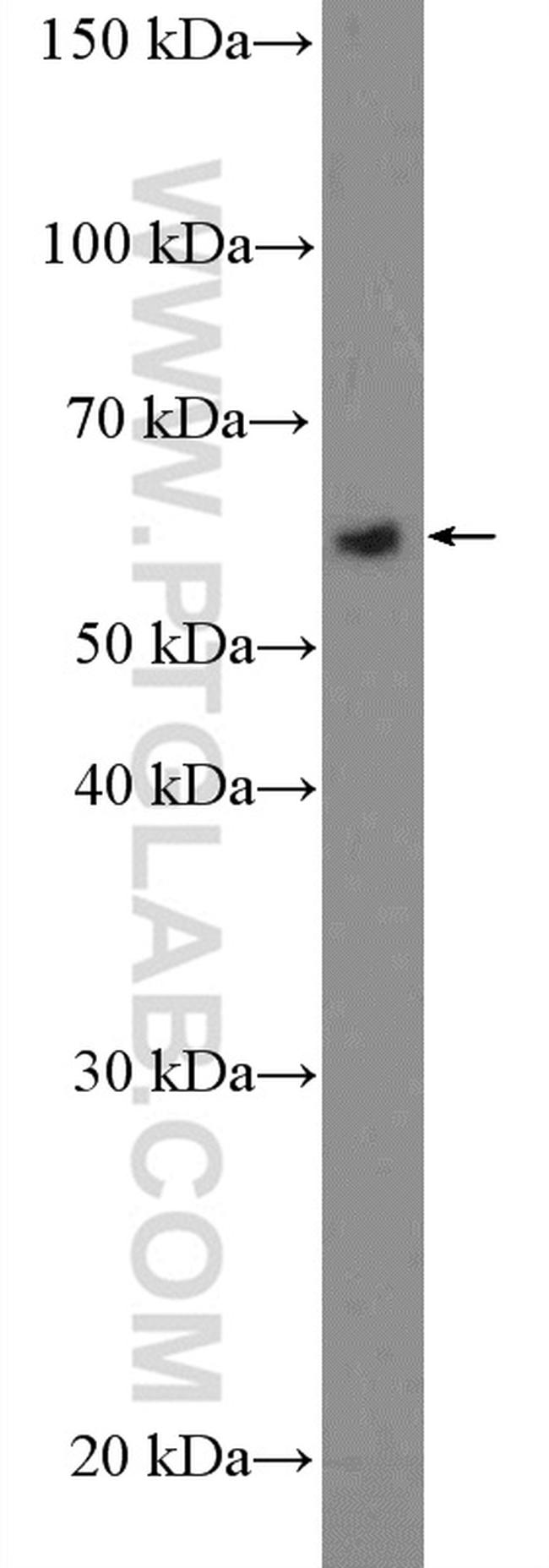 KDM4D Antibody in Western Blot (WB)