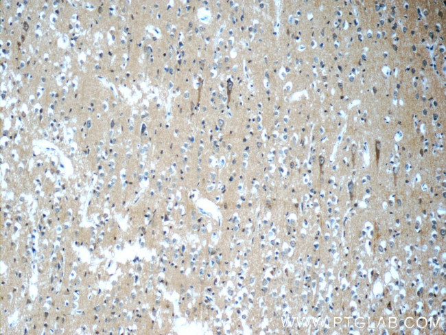 SORLA Antibody in Immunohistochemistry (Paraffin) (IHC (P))