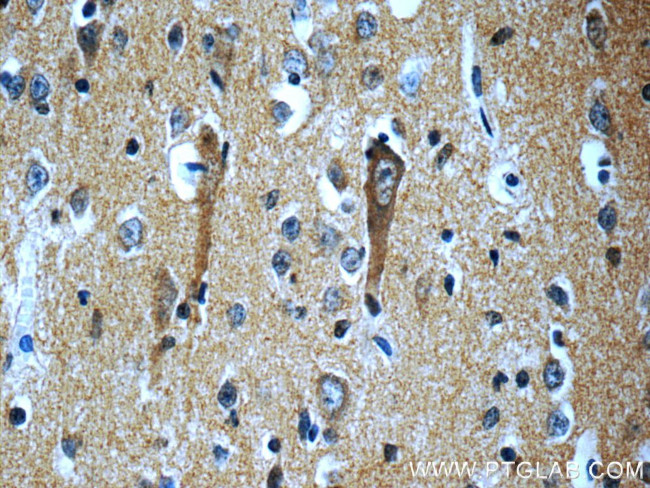 SORLA Antibody in Immunohistochemistry (Paraffin) (IHC (P))