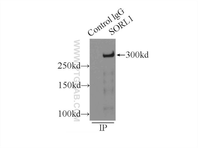 SORLA Antibody in Immunoprecipitation (IP)