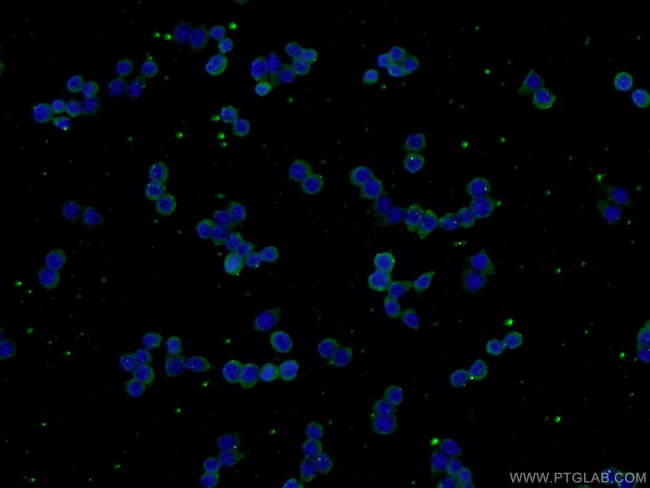 VEGFC Antibody in Immunocytochemistry (ICC/IF)