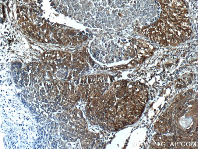 VEGFC Antibody in Immunohistochemistry (Paraffin) (IHC (P))