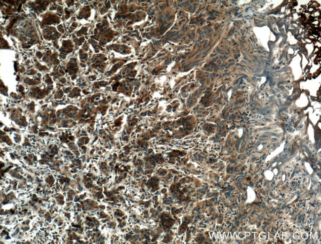 VEGFC Antibody in Immunohistochemistry (Paraffin) (IHC (P))