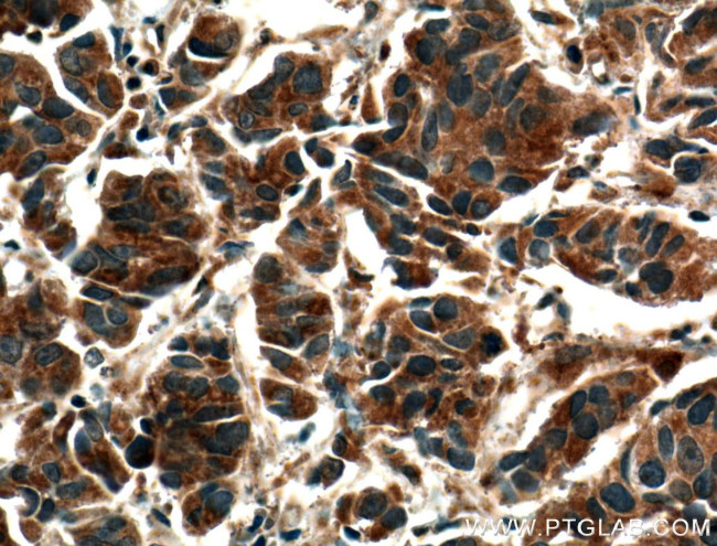 VEGFC Antibody in Immunohistochemistry (Paraffin) (IHC (P))