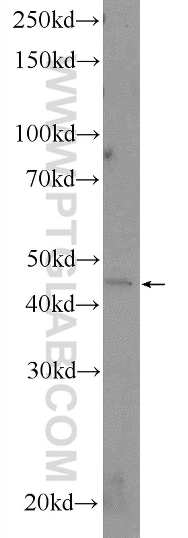 VEGFC Antibody in Western Blot (WB)