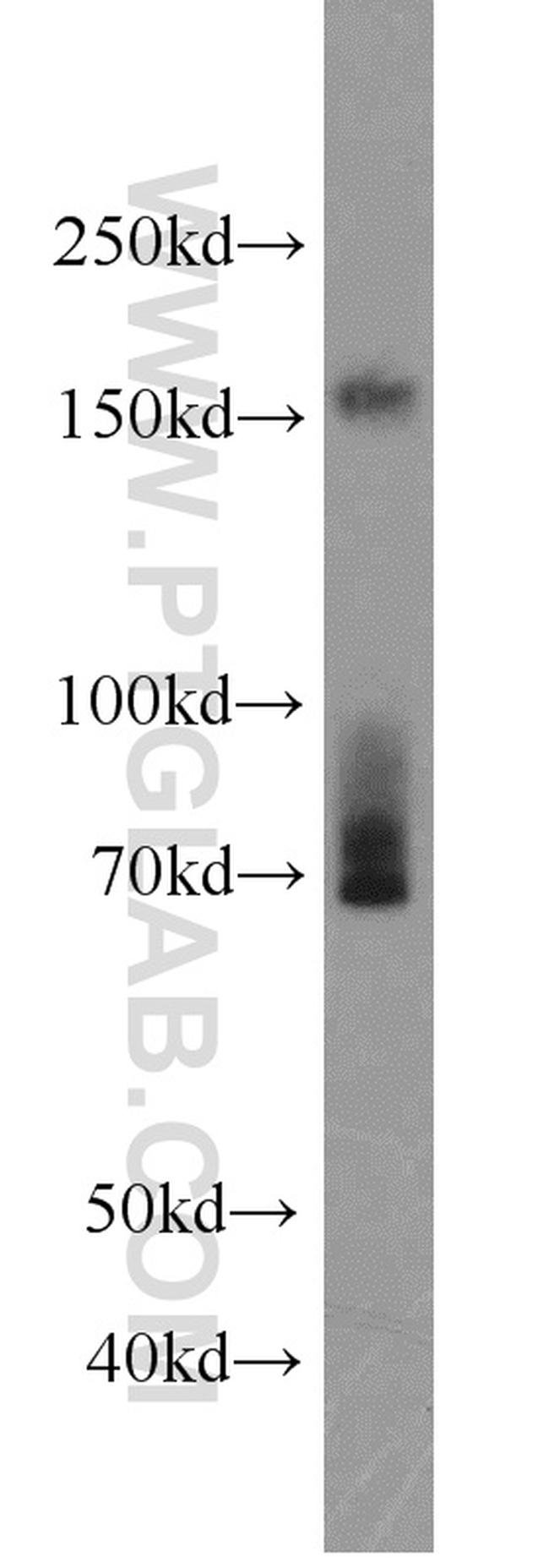 FNDC3B Antibody in Western Blot (WB)