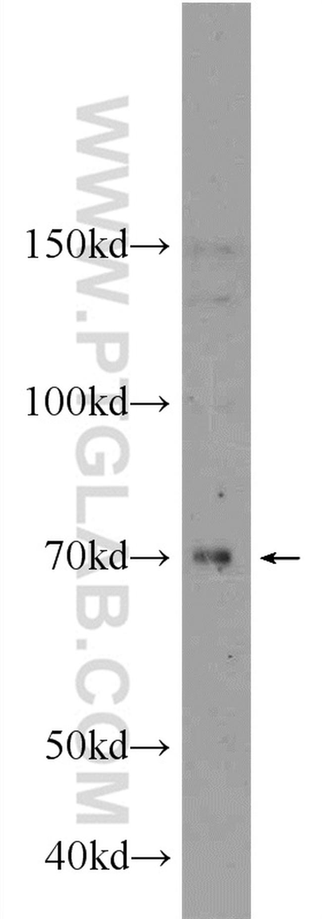 PDE5A Antibody in Western Blot (WB)