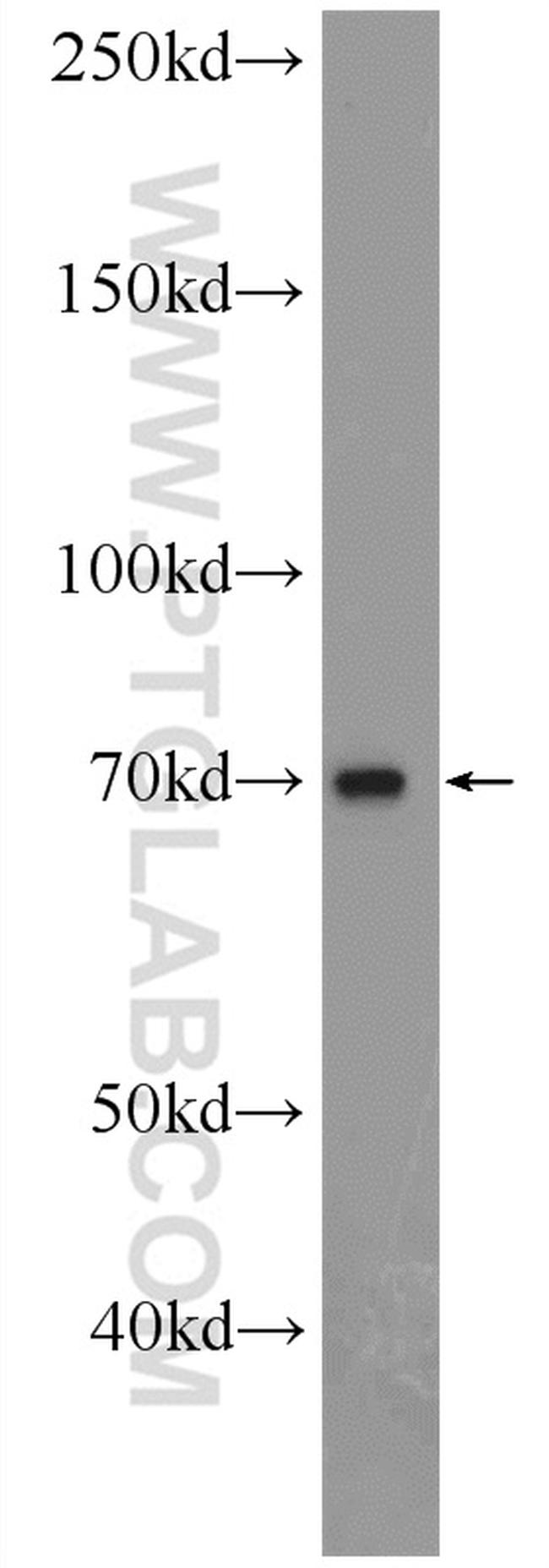 PDE5A Antibody in Western Blot (WB)