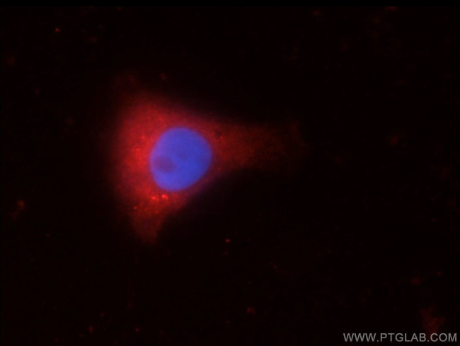 C9orf72 Antibody in Immunocytochemistry (ICC/IF)