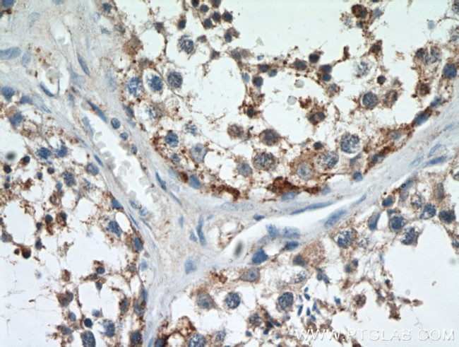 C9orf72 Antibody in Immunohistochemistry (Paraffin) (IHC (P))