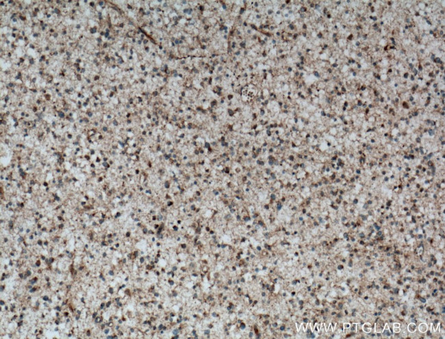 C9orf72 Antibody in Immunohistochemistry (Paraffin) (IHC (P))