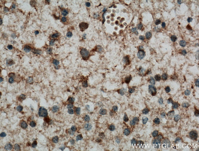 C9orf72 Antibody in Immunohistochemistry (Paraffin) (IHC (P))