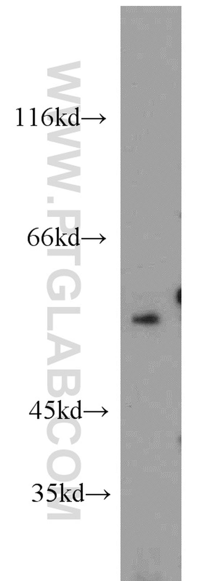 C9orf72 Antibody in Western Blot (WB)