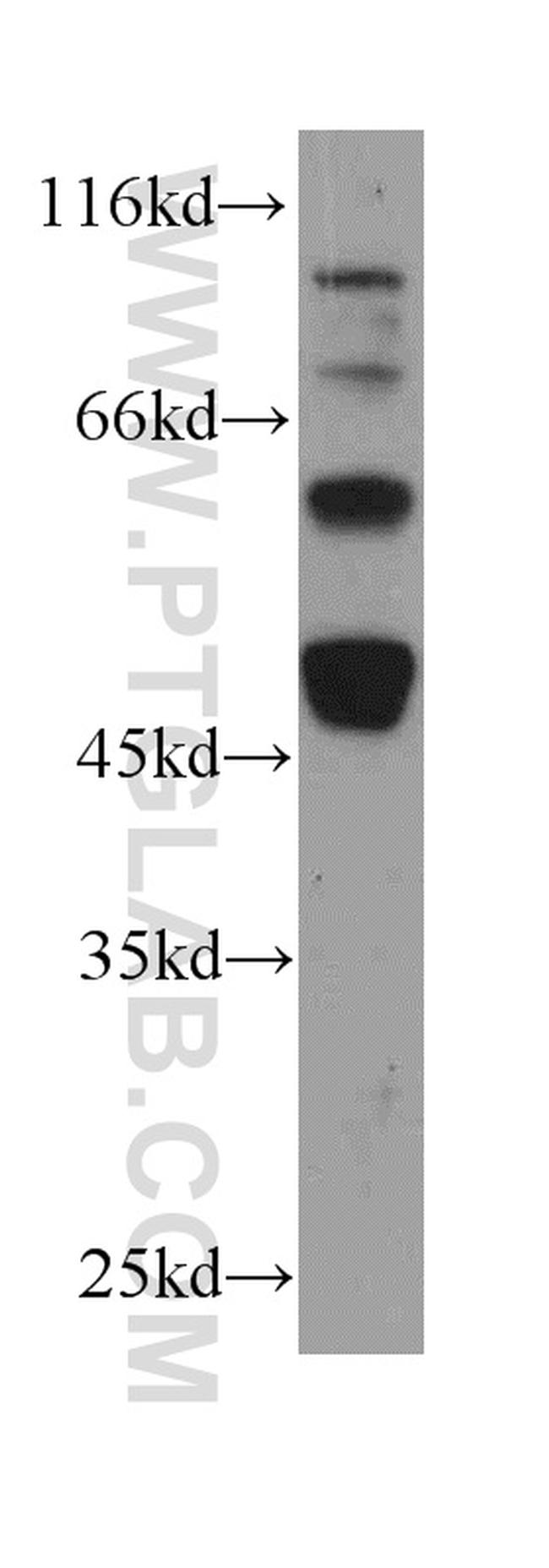 C9orf72 Antibody in Western Blot (WB)