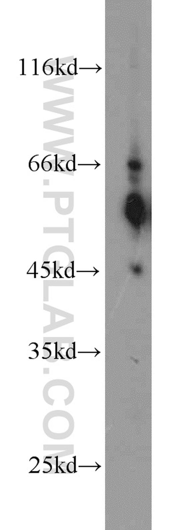 C9orf72 Antibody in Western Blot (WB)