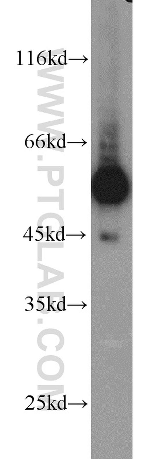 C9orf72 Antibody in Western Blot (WB)