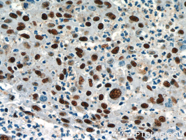 CCAR2 Antibody in Immunohistochemistry (Paraffin) (IHC (P))