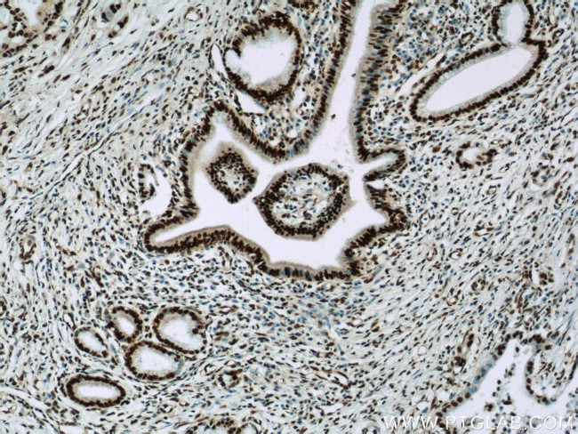 CCAR2 Antibody in Immunohistochemistry (Paraffin) (IHC (P))