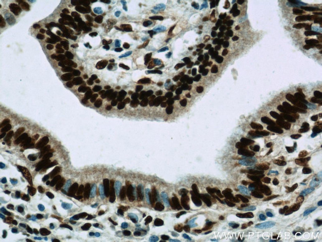 CCAR2 Antibody in Immunohistochemistry (Paraffin) (IHC (P))