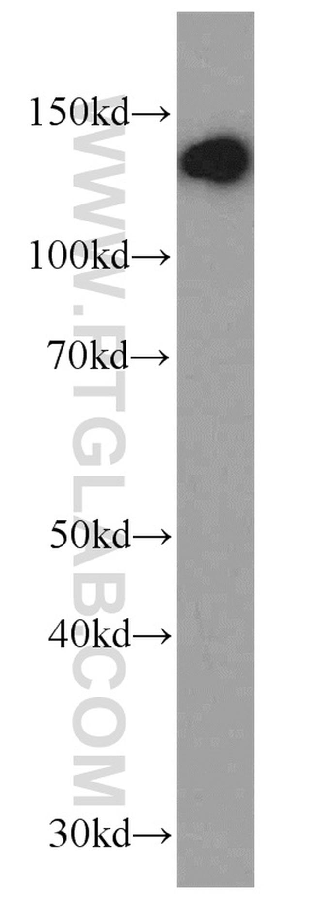 CCAR2 Antibody in Western Blot (WB)