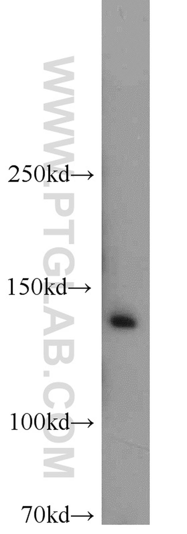 CCAR2 Antibody in Western Blot (WB)