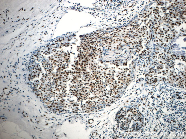 CCAR2 Antibody in Immunohistochemistry (Paraffin) (IHC (P))