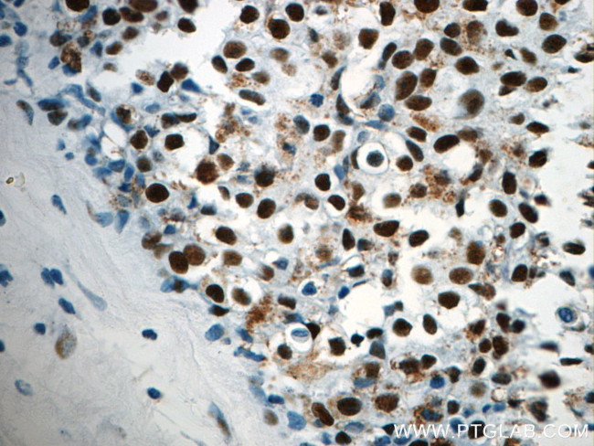 CCAR2 Antibody in Immunohistochemistry (Paraffin) (IHC (P))