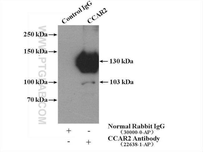 CCAR2 Antibody in Immunoprecipitation (IP)