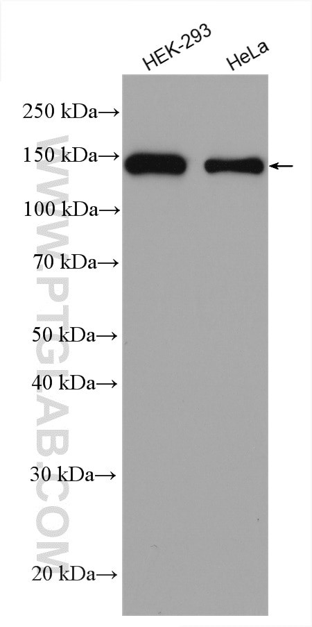 CCAR2 Antibody in Western Blot (WB)