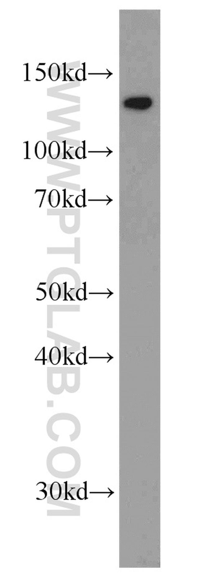 CCAR2 Antibody in Western Blot (WB)