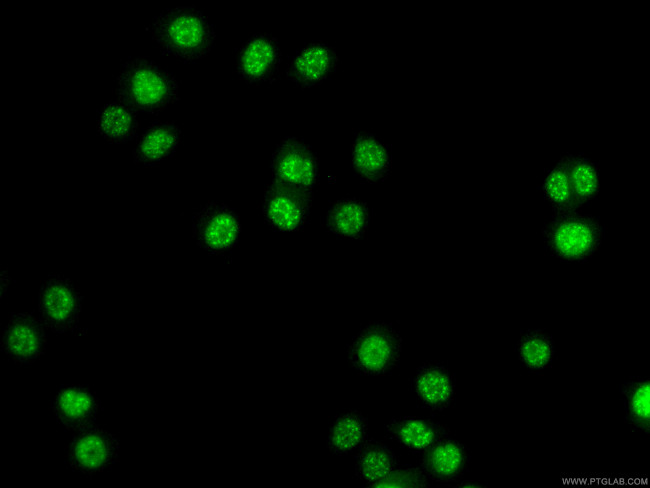 ATOX1 Antibody in Immunocytochemistry (ICC/IF)