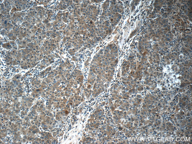 ATOX1 Antibody in Immunohistochemistry (Paraffin) (IHC (P))