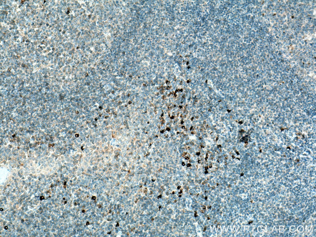 IL-28A Antibody in Immunohistochemistry (Paraffin) (IHC (P))