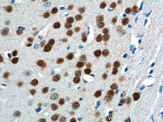 A2BP1 Antibody in Immunohistochemistry (Paraffin) (IHC (P))