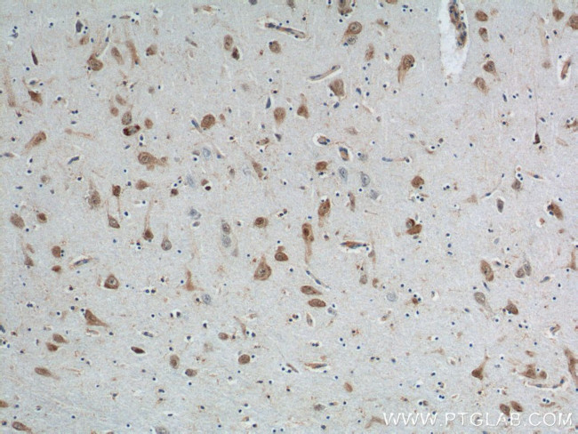 A2BP1 Antibody in Immunohistochemistry (Paraffin) (IHC (P))