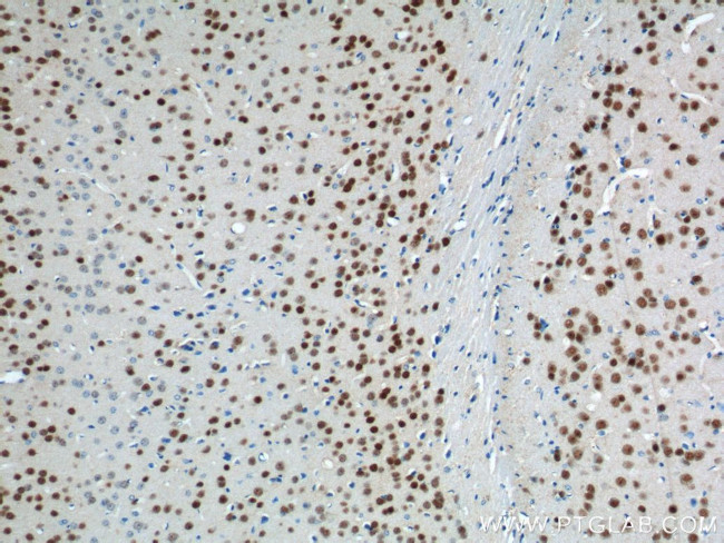 A2BP1 Antibody in Immunohistochemistry (Paraffin) (IHC (P))