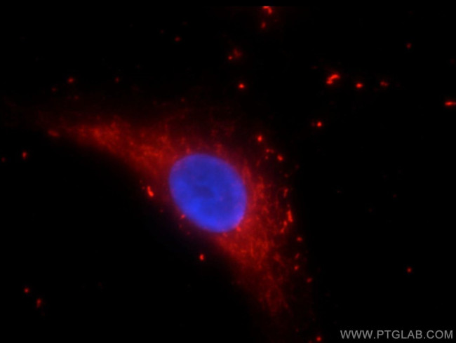 DNASE2B Antibody in Immunocytochemistry (ICC/IF)