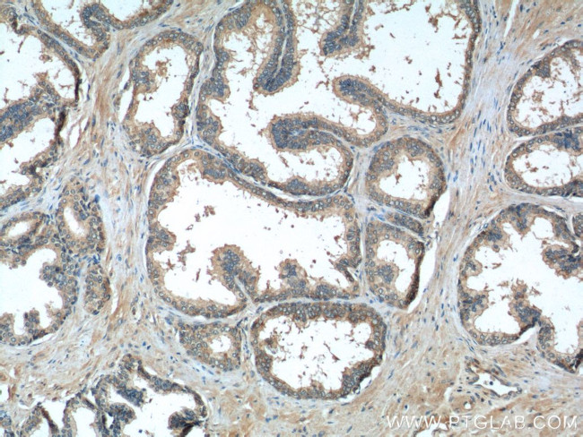 DNASE2B Antibody in Immunohistochemistry (Paraffin) (IHC (P))